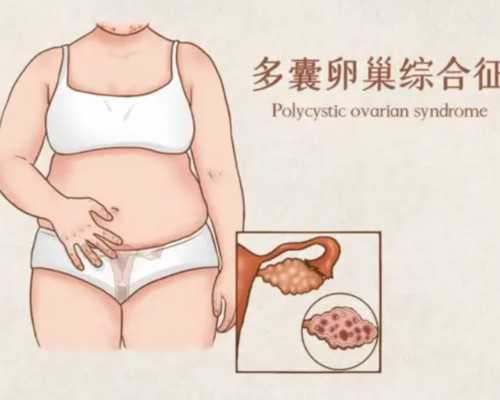 上海有能做供卵三代试管婴儿的私立医院吗？,上海供卵试管中介机构_甲胎蛋白