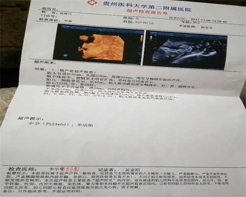 广州代怀孕产子-广州代孕医院【5A认证代怀孕机
