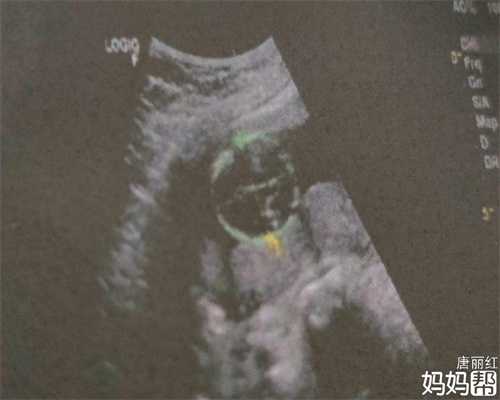 北京招聘代妈公司_有没人愿意代孕的_三个月胎盘