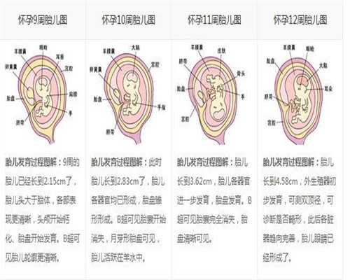 广州供卵试管中心排行:子宫不正怀孕有什么风险