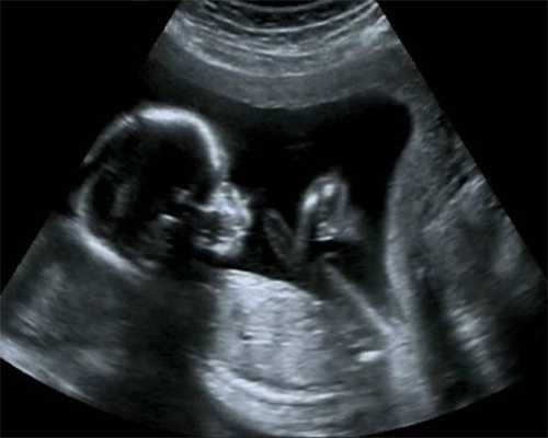 广州供卵试管中心排行:子宫不正怀孕有什么风险