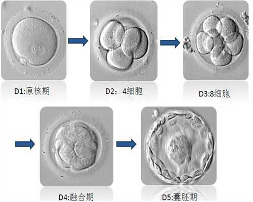 广东代怀孕机构:什么原因引起胎儿囊肿