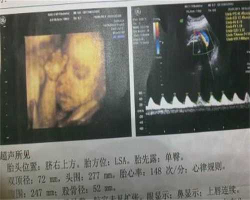 广州知名代怀孕企业:广州哪里有代怀孕的:广州如