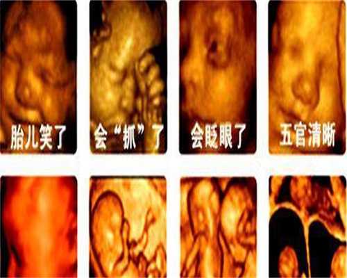 广州做试管代生小孩:孕期第几个月吃燕窝最好