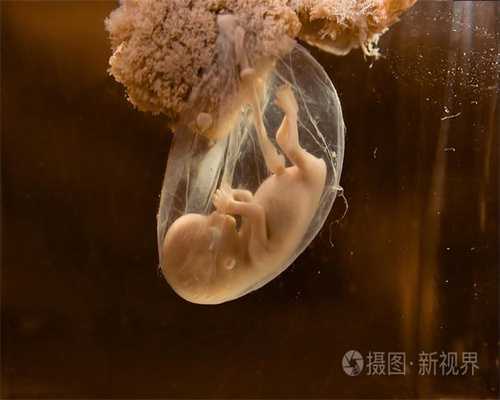 广州人工代孕多少钱:怀孕几个月尿频最严重