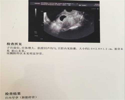 广州助代怀孕包性别:怀孕8个月有什么检查