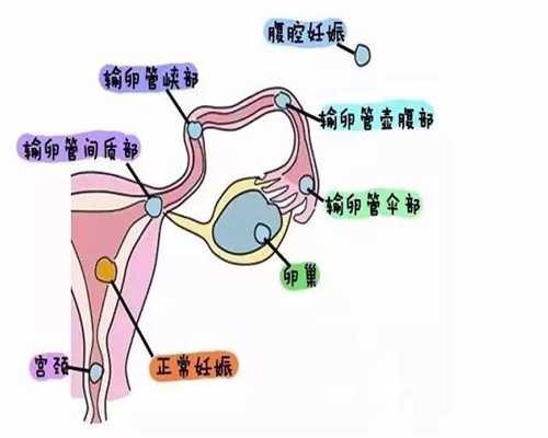 广州提供代怀孕价格:孕妇能不能吃小螺丝肉
