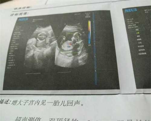 广州代生孩子费用:广州代孕是合法的吗:怀孕第几