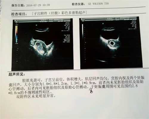 广州代怀孕招聘电话:广州提供代怀孕价格:孕妇能