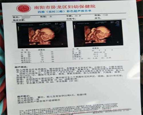 广州代怀孕妈妈招聘:安全期怀孕了有啥症状