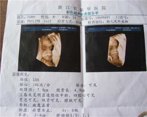 广州代怀孕妈妈招聘:安全期怀孕了有啥症状