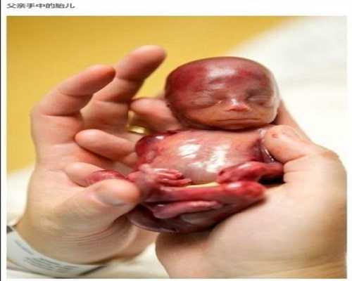 广州代生小孩过程:怀孕初期能不能吃茭瓜