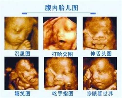 广州哪个医院能代孕:羊水破了肚子会不会变小