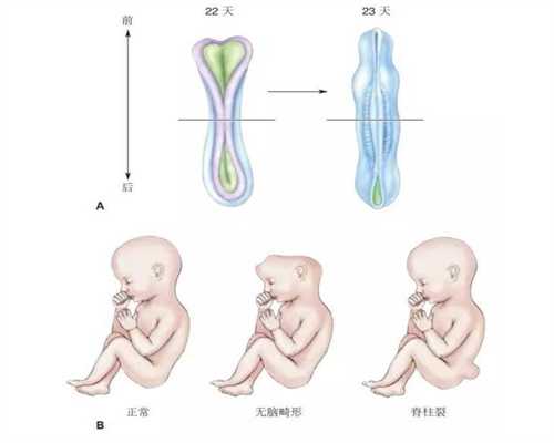 广州没有子宫了可以找代孕_广州哪里代孕比较好_代孕贵不贵：输卵管照影的多