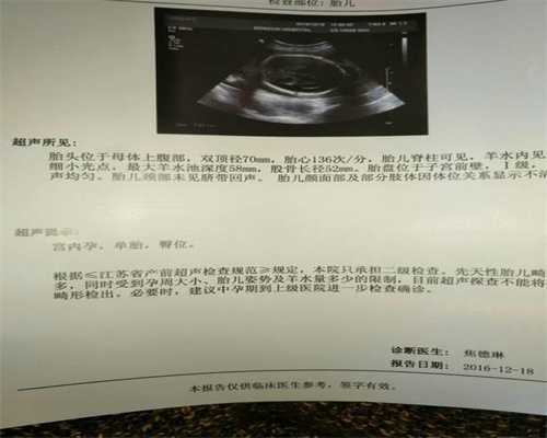 广州代孕可以要龙凤胎吗_广州代孕产子血型_爱维艾夫医院：孕妇一定要左侧睡