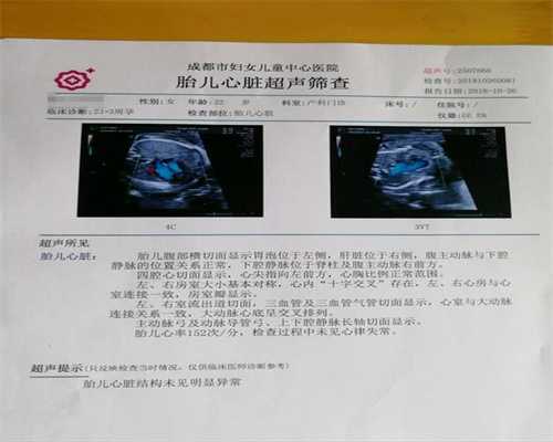 广州代孕成功率多高_广州有没有医院代孕_心安国际深圳：1631344906596