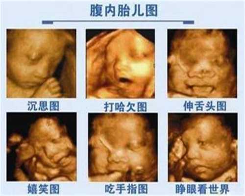 广州代孕什么价位_广州哪里有代孕的女人_上海泰东方试管：发烧真的能长高吗