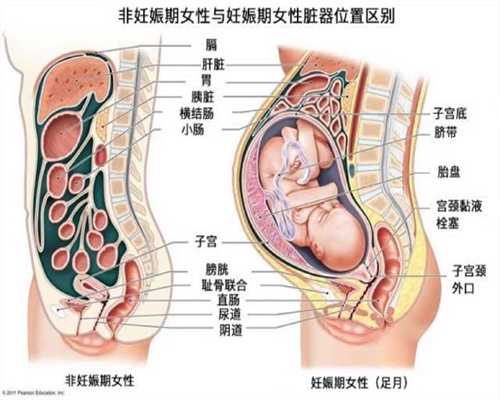 广州代孕产子中心哪家专业_广州代孕有哪些套餐_代孕地址：做好孕前准备工作