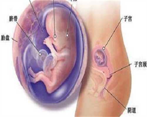 广州代孕在是怎么收_广州想找代孕哪里可以找_三代试管咨询唯美加：妈妈，别