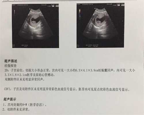 广州哪些地方有代孕的_广州做代孕前的检查
