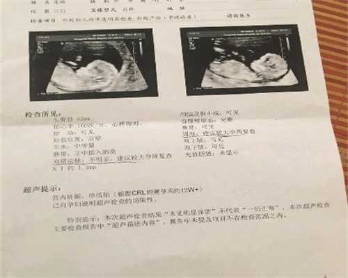 广州代孕价格怎样_广州找个人代孕的有吗