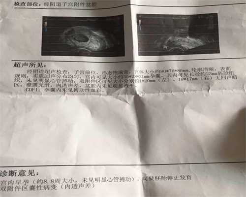 广州最好的代孕医院在哪里_广州没有月经可以代孕吗