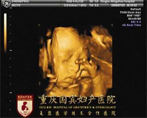 广州全国最好的供卵医院_广州代孕第三代代孕