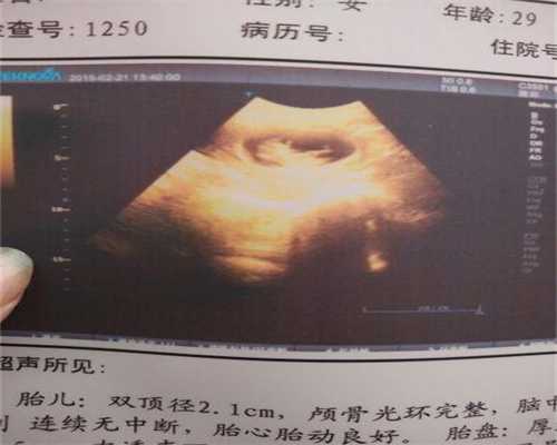 广州三代试管婴儿包成功_广州合法代助孕