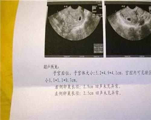 广州国内可以供卵试管吗_广州国内那里有靠谱代孕