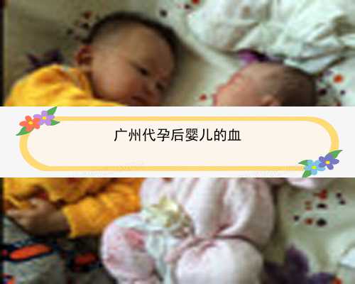 广州哪里需要代孕母亲|6BgPt_38781_63129_71iVy_白带清洁度3度是怎么回事？需要治疗