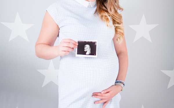 代孕产子广州的流程 广州妇幼医疗中心 ‘怀孕四个月男宝b超图怎么看’