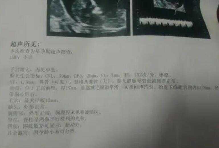 广州专业供卵代怀多少钱 广州有没有设立专门的卵子库？ ‘孕9周胎囊多大是男