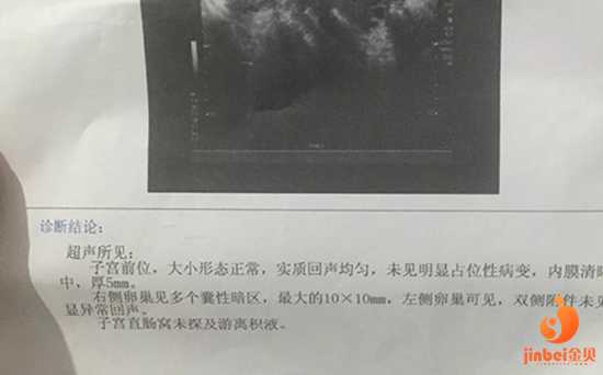 广州哪家代生好|【广州哪家医院可以做供卵试管婴儿】医生询问以前有没有做